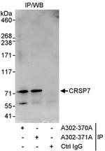 CRSP7 Polyclonal Antibody