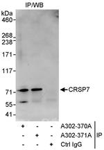 CRSP7 Polyclonal Antibody