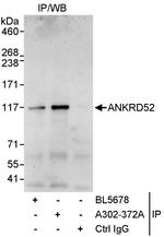 ANKRD52 Polyclonal Antibody