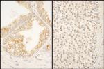 FBXO38 Polyclonal Antibody