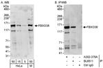 FBXO38 Antibody in Western Blot (WB)