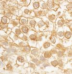 BORG4 Polyclonal Antibody