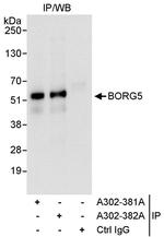 BORG5 Antibody in Immunoprecipitation (IP)