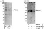 FOXC2 Polyclonal Antibody
