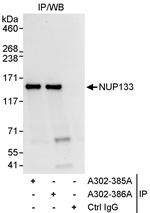NUP133 Polyclonal Antibody