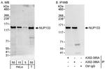 NUP133 Polyclonal Antibody
