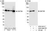 ZNF768 Antibody in Western Blot (WB)