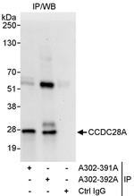 CCDC28A Polyclonal Antibody