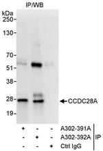 CCDC28A Polyclonal Antibody