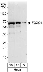 FOXO4 Polyclonal Antibody