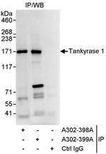 Tankyrase 1 Polyclonal Antibody