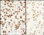 NPM1 Polyclonal Antibody