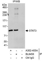 STAT3 Antibody in Immunoprecipitation (IP)