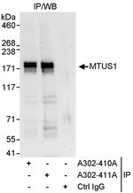 MTUS1 Polyclonal Antibody
