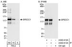SPECC1 Antibody in Western Blot (WB)