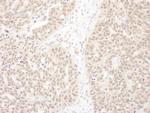 WDR5 Polyclonal Antibody