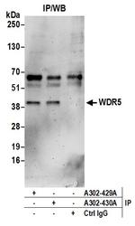 WDR5 Antibody in Immunoprecipitation (IP)