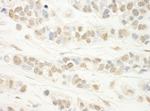 WDR5 Polyclonal Antibody