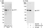 ATF7 Antibody in Western Blot (WB)
