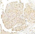 NRIP Polyclonal Antibody