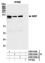 NRIP Antibody in Immunoprecipitation (IP)