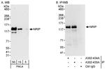 NRIP Antibody in Western Blot (WB)