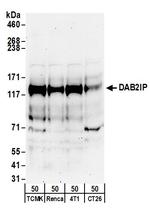 DAB2IP Polyclonal Antibody