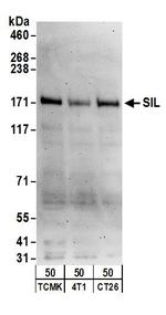 SIL Polyclonal Antibody