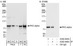 PKC-alpha Antibody in Western Blot (WB)