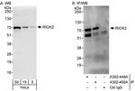 RIOK2 Polyclonal Antibody