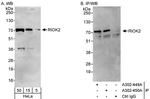 RIOK2 Polyclonal Antibody
