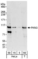 PKN3 Polyclonal Antibody