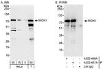 RIOK1 Polyclonal Antibody