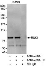 RSK1 Antibody in Immunoprecipitation (IP)
