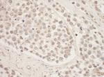 SRPK1 Polyclonal Antibody