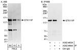 STK11IP Polyclonal Antibody