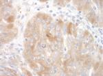SRPK2 Polyclonal Antibody
