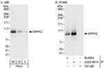 SRPK2 Antibody in Western Blot (WB)