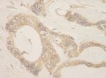 CASC3 Antibody in Immunohistochemistry (Paraffin) (IHC (P))