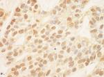 ZEB2/SIP Polyclonal Antibody
