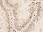 ZEB2/SIP Polyclonal Antibody