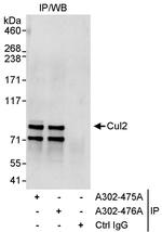 Cul2 Antibody in Immunoprecipitation (IP)