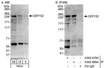 CEP152 Polyclonal Antibody
