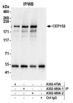 CEP152 Polyclonal Antibody