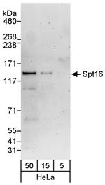 Spt16 Antibody in Western Blot (WB)