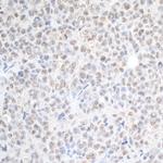SPF45 Polyclonal Antibody