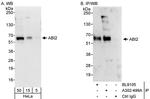 ABI2 Polyclonal Antibody