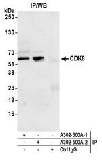 CDK8 Polyclonal Antibody