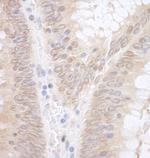 EAF2 Polyclonal Antibody