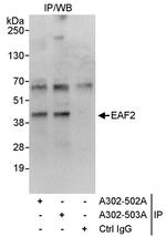EAF2 Antibody in Immunoprecipitation (IP)